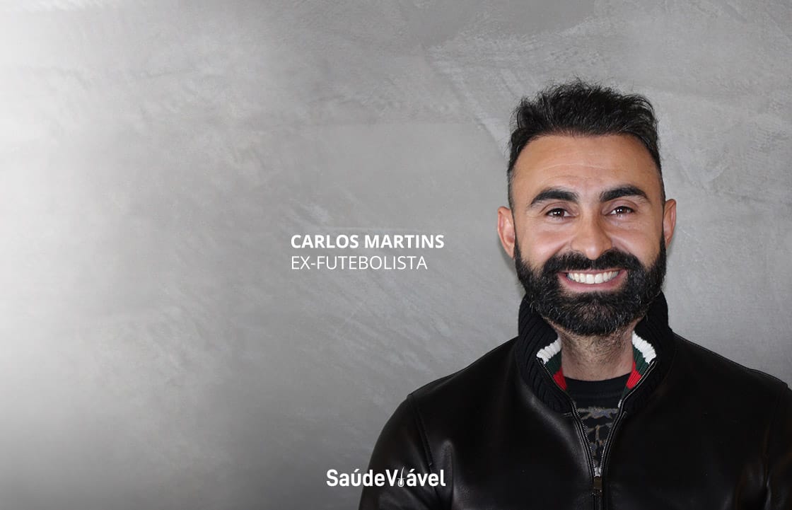 Testemunho do Carlos Martins Transplante Capilar Antes e Depois, Carlos Martins