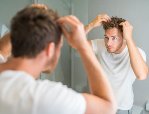 Curiosidades da perda de cabelo