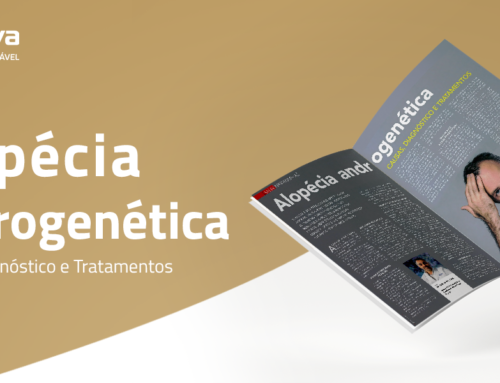 Alopécia: Quais as causas, sintomas e tratamentos eficazes?