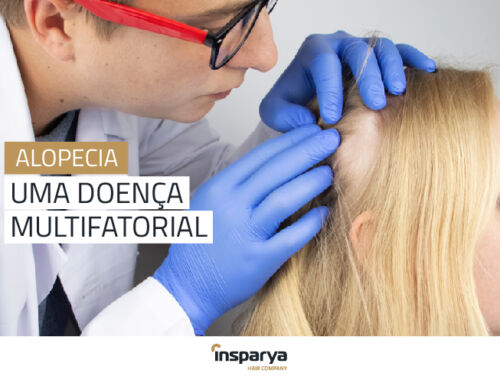 Alopecia, uma doença multifatorial.