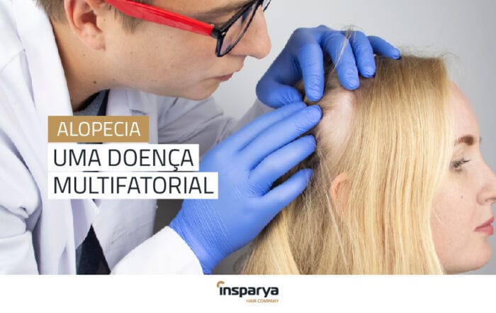 Insparya - Alopecia uma doença multifatorial