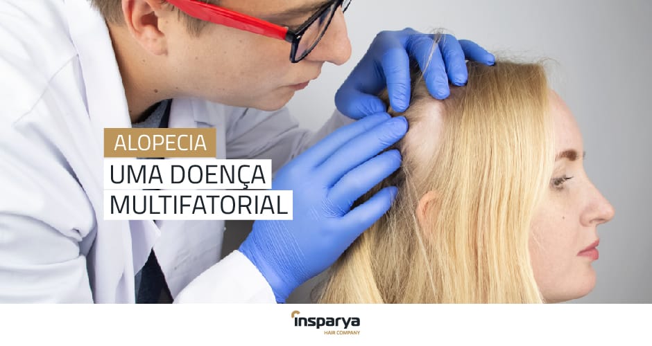 Insparya - Alopecia uma doença multifatorial