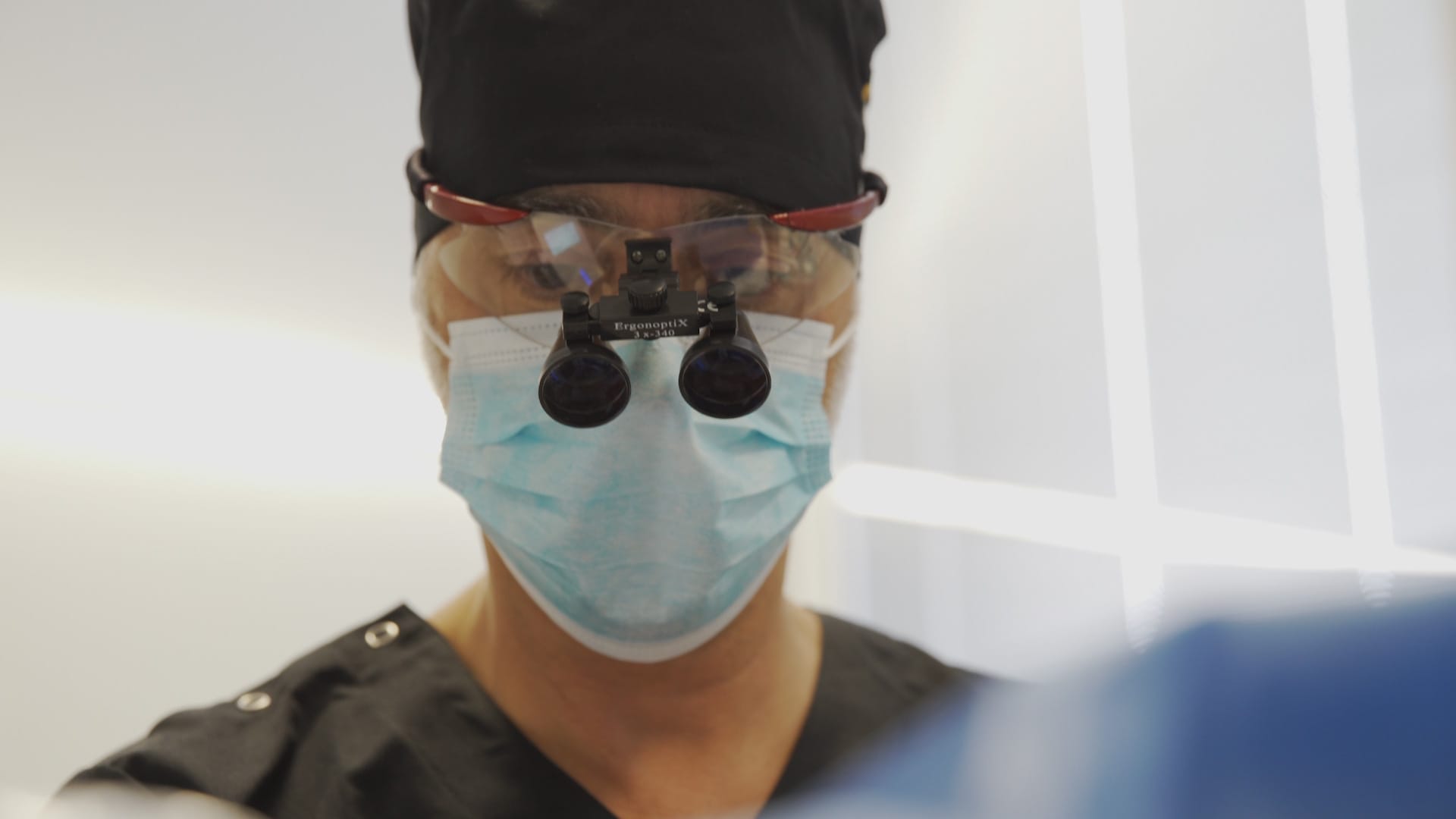 Transplante Capilar com o Dual Extration Device