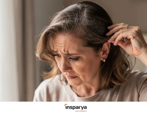 Queda de cabelo nas mulheres: porque acontece e como tratar