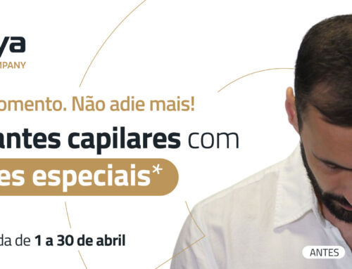 Não adie mais a sua decisão: agora é o momento para realizar o seu transplante capilar