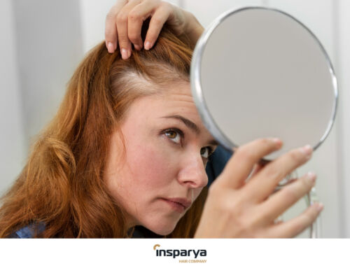 Primeiros sinais de alopécia: como detetá-los a tempo 