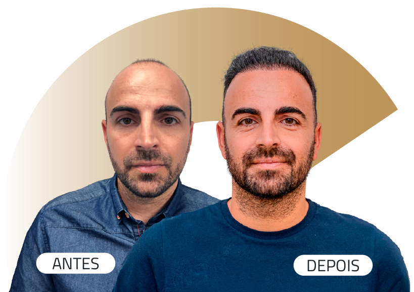 Insparya Antes / Depois