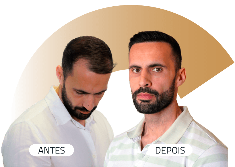 Insparya Antes / Después