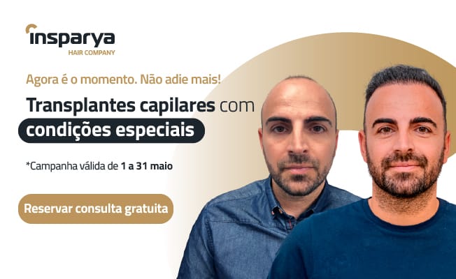 Transplantes capilares com condições especiais. Reservar consulta gratuita