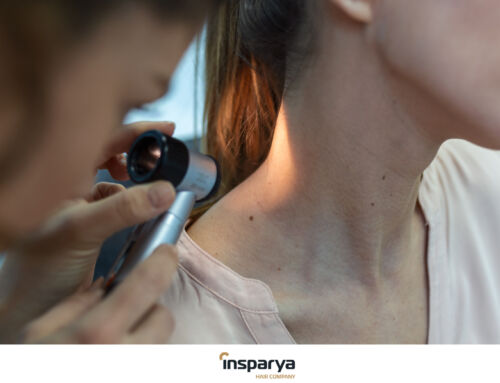 Melanoma no couro cabeludo:    sinais de alerta, prevenção e impacto na saúde capilar 