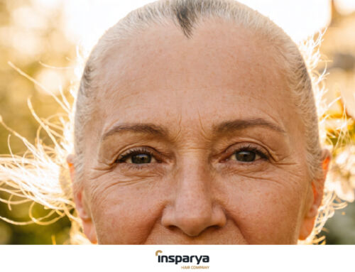 Alopécia Fibrosante Frontal (AFF): o que é, sintomas e tratamentos